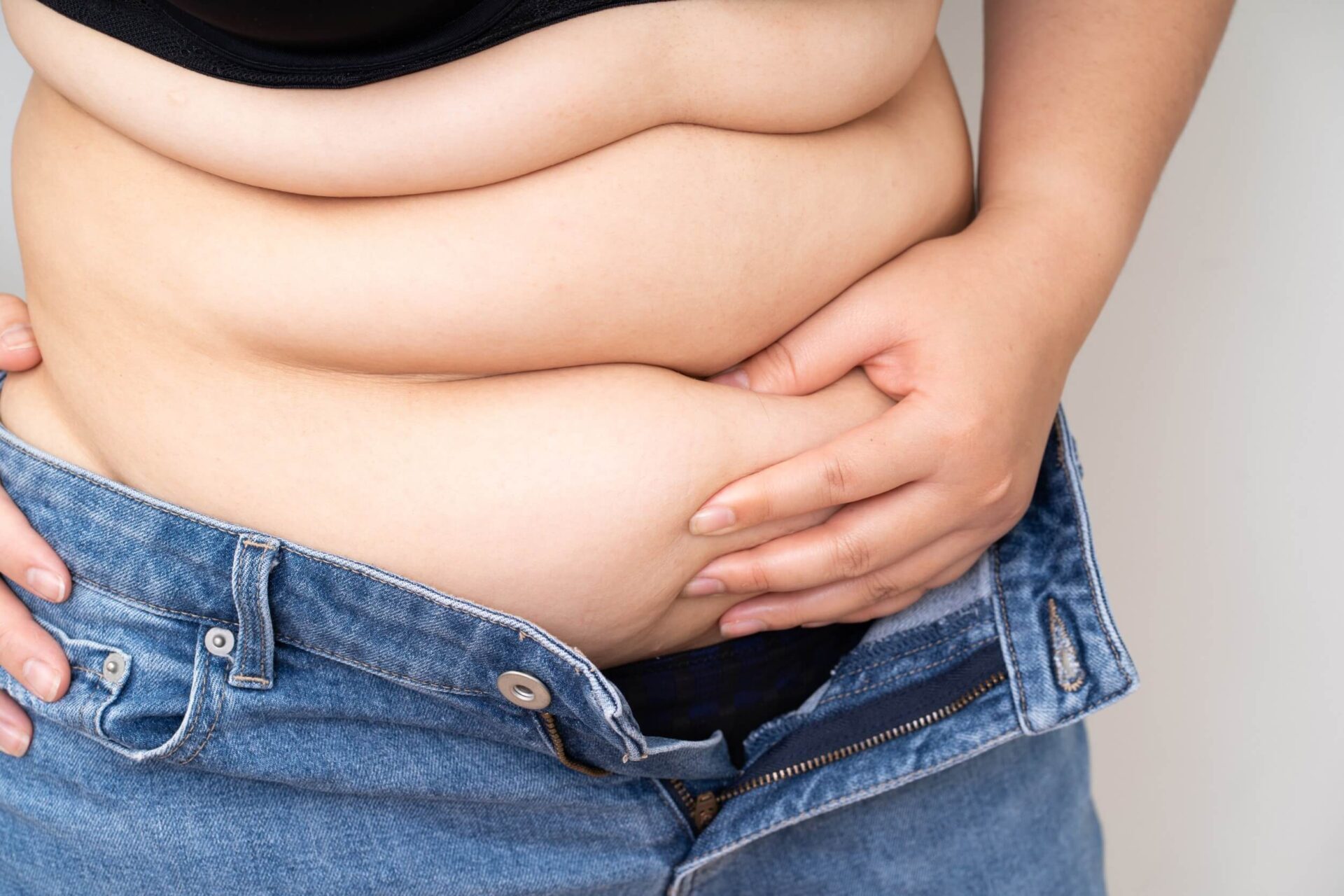 โรคอ้วน